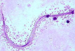 <i>Mansonella</i> Genus of roundworms