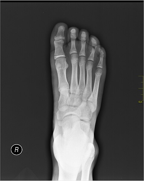 File:Medical X-Ray imaging PVP06 nevit.jpg