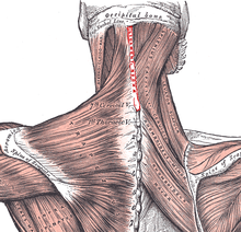 Nuchal ligament.PNG