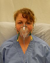 A person wearing a simple face mask for oxygen therapy Simple face mask.jpg