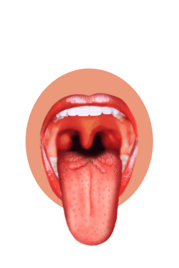 English: This is a tongue