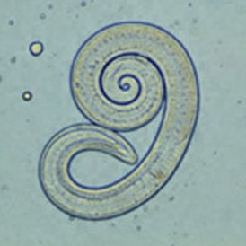 Личинка нематоды Trichinella spiralis