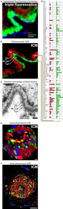 Comparison of dimension-unlimited fluorescence imaging cycler microscopy (ICM) and standard three-parameter fluorescence microscopy Comparison of dimension-unlimited epifluorescence imaging cycler microscopy (ICM) and standard three-parameter fluorescence microscopy..jpg