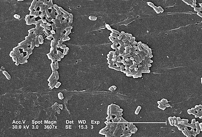 Escherichia coli is a Gram-negative bacterium that normally colonizes the digestive tract of most warm-blooded animals.One strain of E. coli, O157:H7, causes an estimated 73,000 cases of infection, and 61 deaths in the United States each year