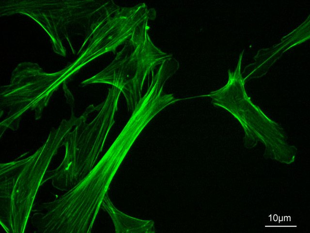 Actin cytoskeleton of mouse embryo fibroblasts, stained with Fluorescein isothiocyanate-phalloidin