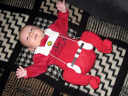 Baby wearing a Pavlik harness
