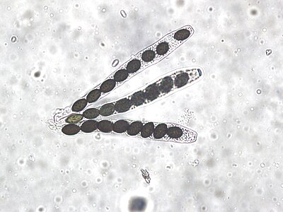 ascospores under microscope