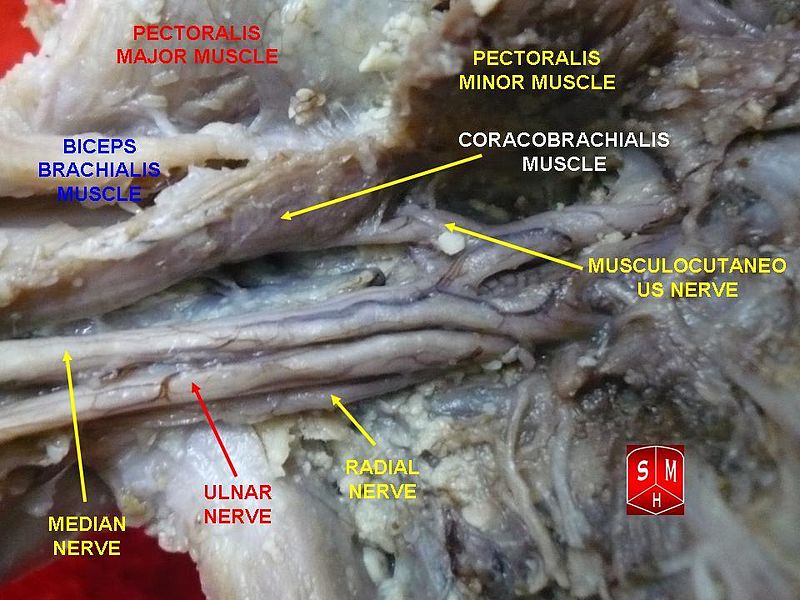 File:Brachial plexus 1.jpg