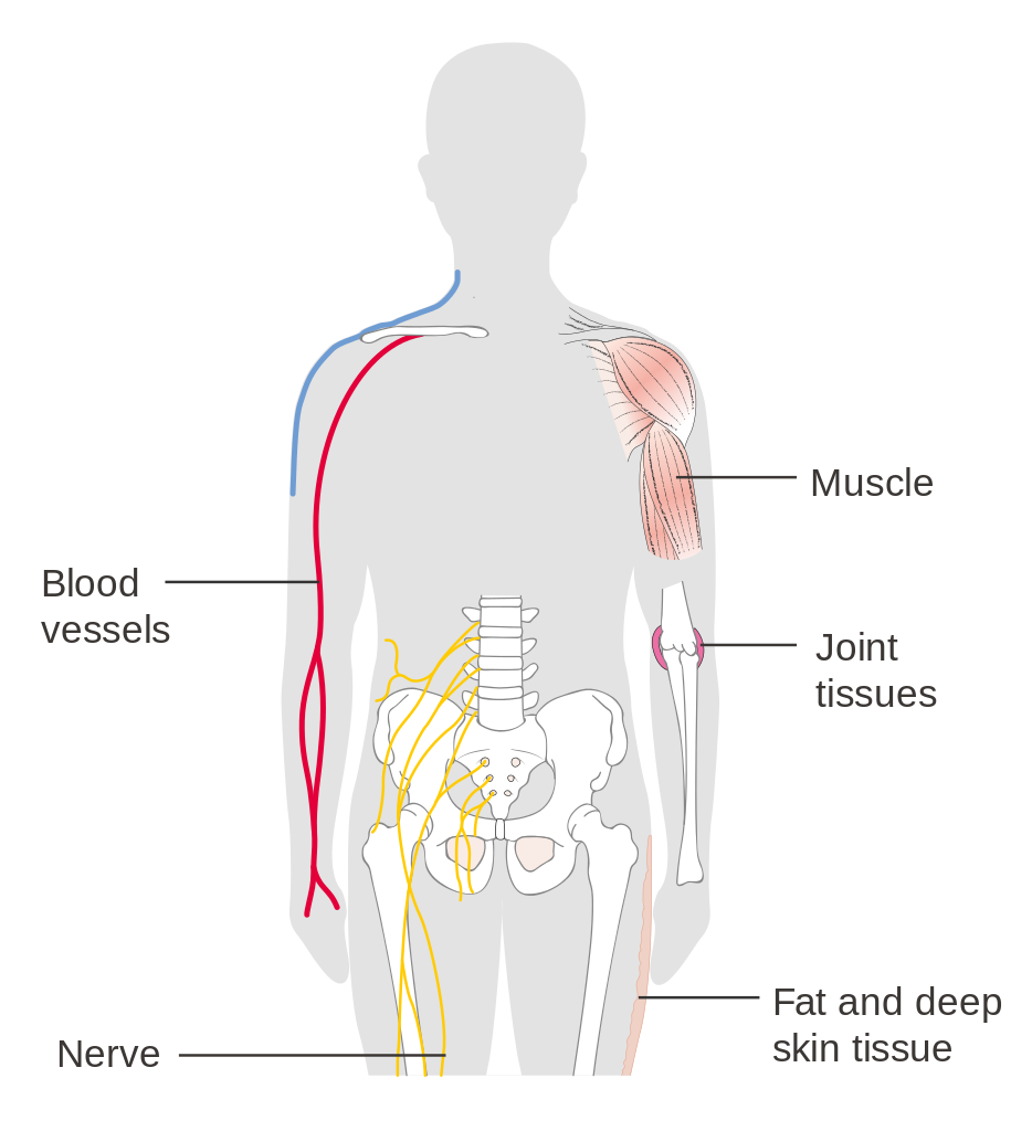 File:DIagram of the different types of soft tissue in the body CRUK 037.svg  - Wikimedia Commons