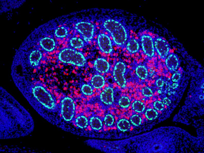 File:E15.5 mouse embryonic testes.tif