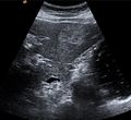 Medical Ultrasound