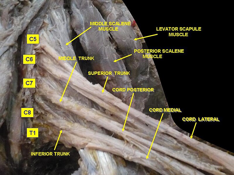 File:Slide1cord.JPG