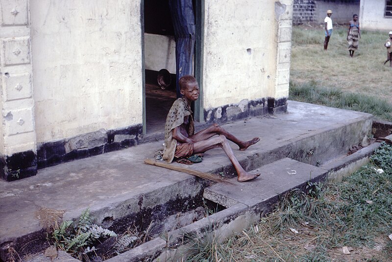 File:Starving-woman-africa-biafra-nigeria-conflict-famine.jpg