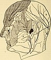 Diseases of the nervous system (1910) (14770796114).jpg