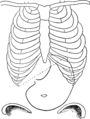 Page 70; Français : Figure 20 (d’après Rosenheim). Dislocation totale d’un estomac normal. Gonflement artificiel. Le caria est abaissé. Vaste poche sous-pylorique due au mouvement de bascule de l’estomac en bas, et plutôt à droite qu’à gauche. - Bord inférieur du foie.