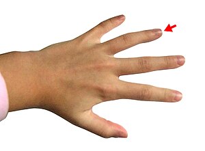 Hand - Ring finger.jpg