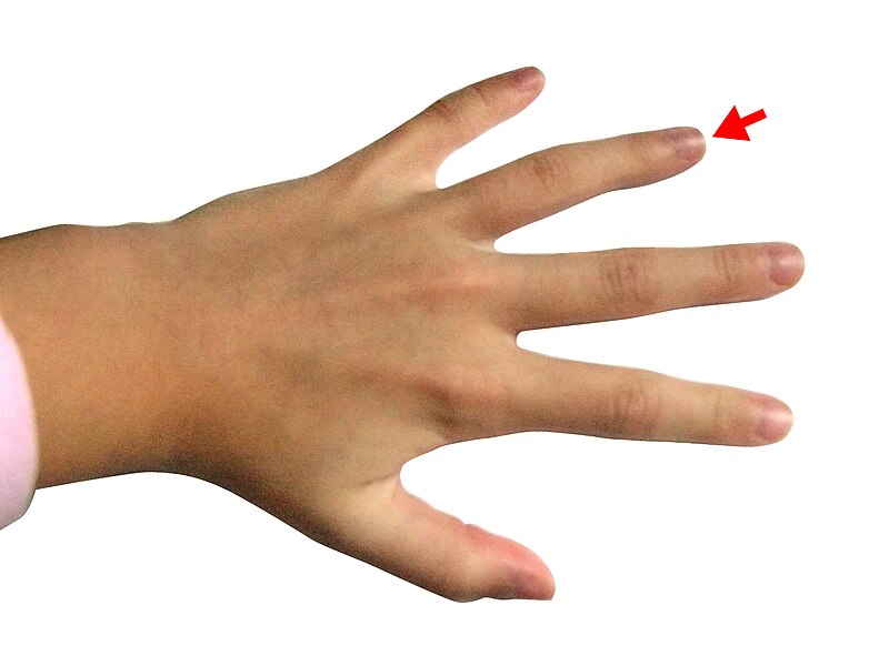 File:Hand - Ring finger.jpg