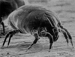 The house dust mite, its feces and chitin are common allergens House Dust Mite.jpg