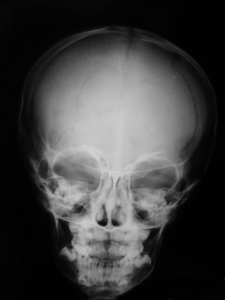 File:Radiology 1300514 Nevit.jpg