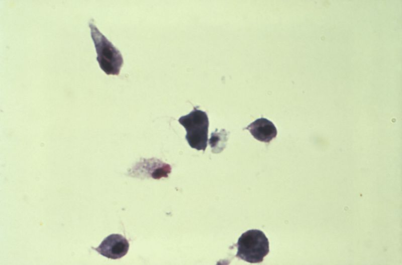 File:Trichomonas vaginalis 01.jpg