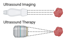 Ultrasound Imaging vs. Ultrasound Therapy Ultrasound Imaging vs. Ultrasound Therapy.png