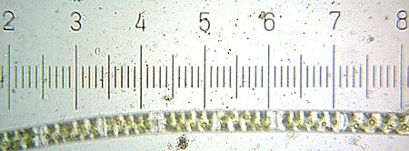 Tập_tin:20090328_2222_Spirogyra.jpg