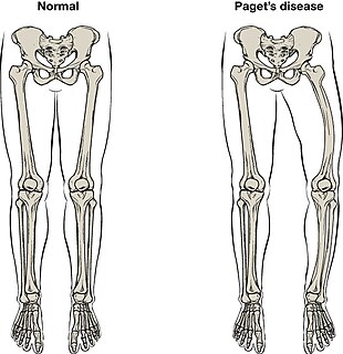 Orthopedic pathology