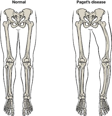 Orthopedic pathology