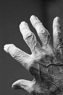 The hand of an older adult Altenpflege 02.jpg