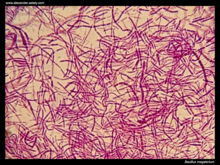 Gram-stained Bacillus megaterium Bacillus megaterium 1000x magnification.png