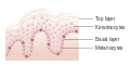Diagram showing the types of cells in the epidermis CRUK 464.svg