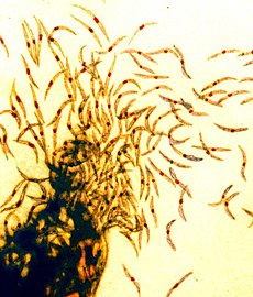 Sporozoites, one of several different forms of the parasite, from a mosquito