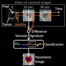 Parametric imaging of vascular signatures (diagram) Parametric Imaging of Vascular Signatures.jpg