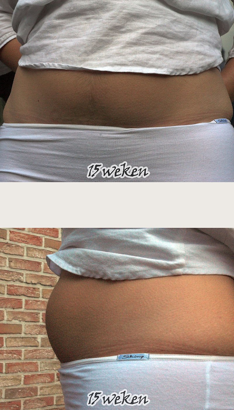 15 Weeks Pregnant Photo