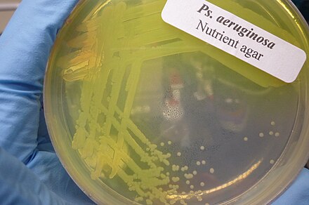 A culture dish with Pseudomonas