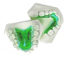 Upper and Lower Jaw Functional Expanders.jpg