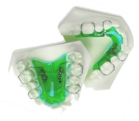 Fail:Upper and Lower Jaw Functional Expanders.jpg