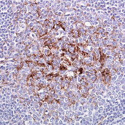 Koepala, jossa vCJD. Prioniproteiini immunovärjätty.