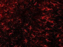 Reactive astrocytes in a rat brain stained against GFAP. 2010-3-15 rGFAP 1-4000 1-200 Hip 20x(4).tif