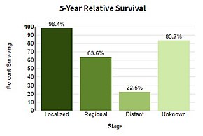 5-year relative survival by stage at diagnosis for melanoma of the skin in the United States as of 2014 5YearSurvival2008to14.jpg