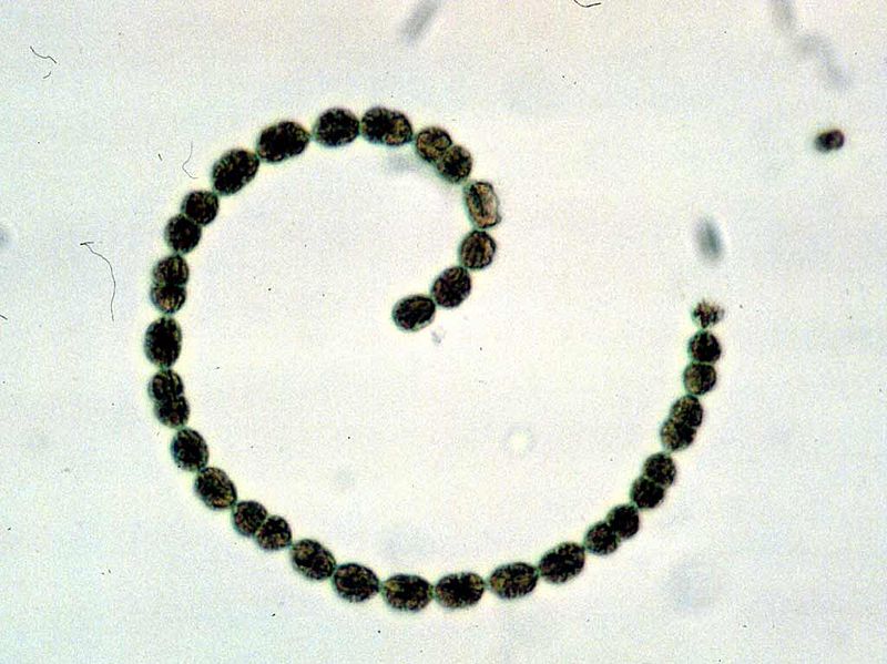 File:Anabaenaflosaquae EPA.jpg