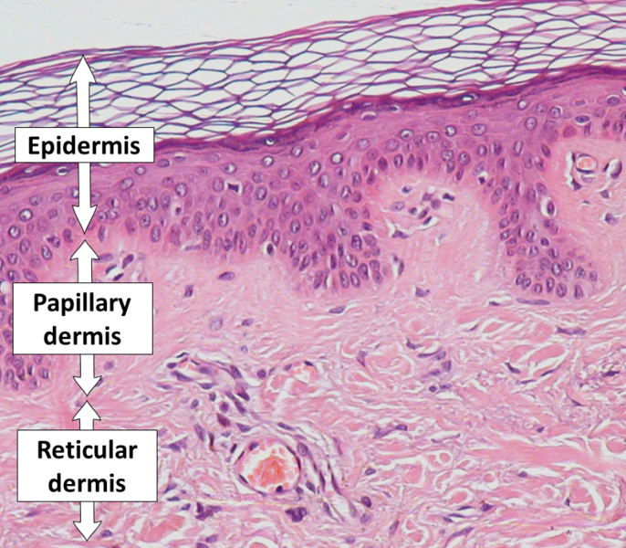 File:Epidermis, papillary dermis and reticular dermis.png