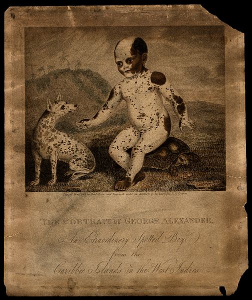 File:George Alexander, a black boy with white markings. Engraving Wellcome V0006960.jpg