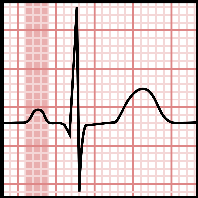 Electrocardiography - Wikipedia