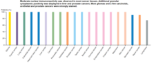 WWTR1 protein is expressed in moderate to high levels across a diverse array of cancer types and is associated with poor clinical outcomes. Protein Atlas WWTR1 Protein Expression Intensity by Cancer - CAB017483.png