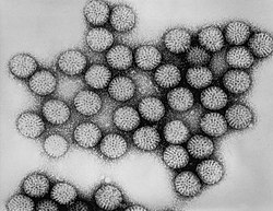 Rotavirus TEM B82-0337 lores.jpg