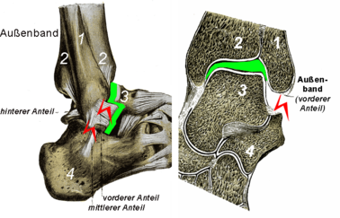 Instabilität des Außenbandapparates Links: Das Sprungbein lässt sich nach vorne ziehen. Rechts: Das obere Sprunggelenk ist seitlich aufklappbar. (1 Wadenbein , 2 Schienbein, 3 Sprungbein und 4 Fersenbein).