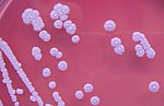 Hình thu nhỏ cho Burkholderia pseudomallei