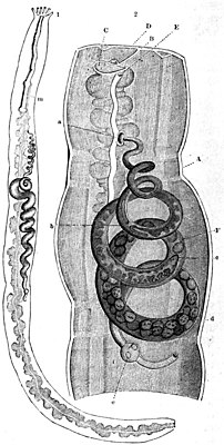 Snail tube (Entoconcha mirabilis) in the sea cucumber Oestergrenia digitata.  Brehm's Thierleben, 1893