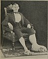 Американец с элефантиазом ног (незадолго до 1900 года)